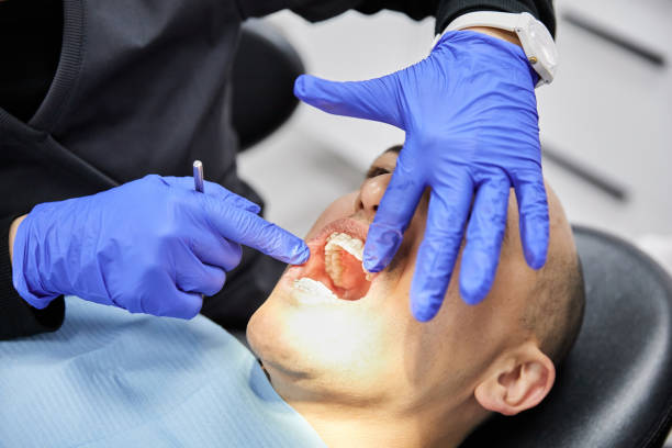 Best Urgent Care for Lost Fillings or Crowns in Rosedale, MD